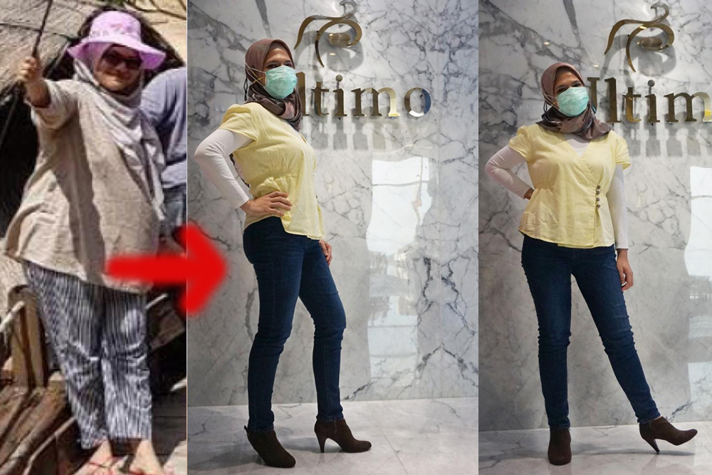 Dermatological,Service,,Blackhead,Removal,,Facial,Treatment,,Skin,Enhancement,Service