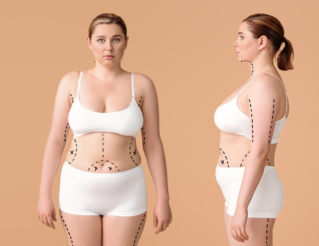 Overweight,Woman,On,Color,Background.,Weight,Loss,Concept