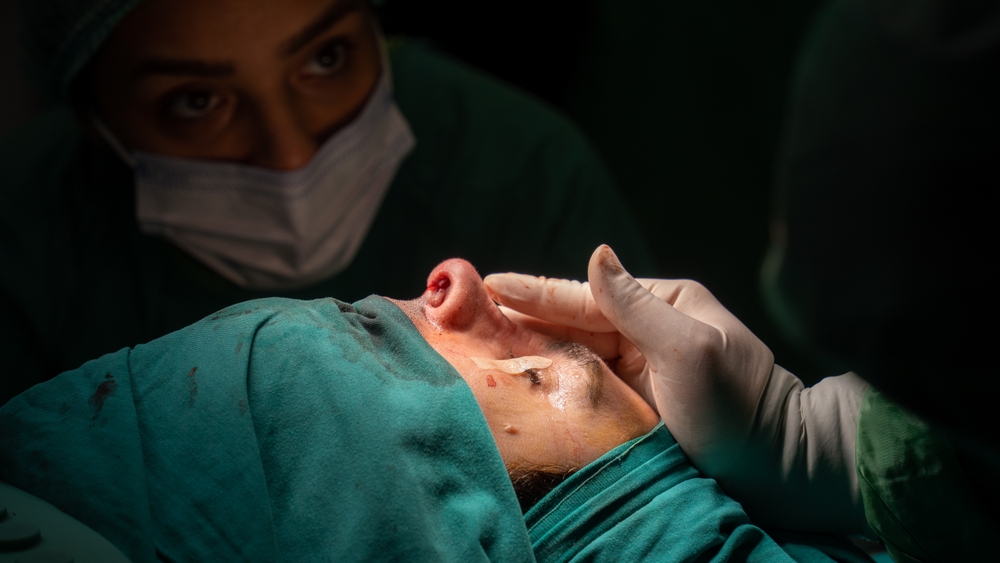 Rhinoplasty,Surgery,,Defects,In,The,Shape,Of,The,Nose,In