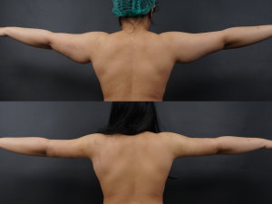 foto before after pasien (Copy)